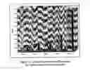 Fig. 08 - Process for controlling the density, conformation and composition of the hydrophilic layer of a polyurethane composite