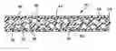 Fig. 01 - Cross-directional elastic films with machine direction stiffness