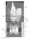Fig. 07 - User interface having cross section control tool for digital orthodontics