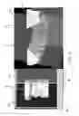 Fig. 09 - User interface having cross section control tool for digital orthodontics
