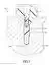 Fig. 04 - Force distributing dental implant assembly