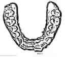 Fig. 05 - Image-based orthodontic treatment viewing system