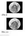Fig. 06 - Interventional simulator system