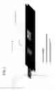 Fig. 03 - Method for the rapid diagnosis of targets in human body fluids