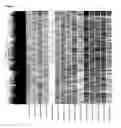 Fig. 05 - Altered gene expression profiles in stable versus acute childhood asthma