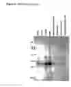 Fig. 16 - ME-5, ME-2, and EPP2: human protein antigens reactive with autoantibodies present in the serum of women suffering from endometriosis
