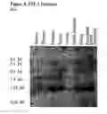 Fig. 17 - ME-5, ME-2, and EPP2: human protein antigens reactive with autoantibodies present in the serum of women suffering from endometriosis