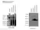 Fig. 18 - ME-5, ME-2, and EPP2: human protein antigens reactive with autoantibodies present in the serum of women suffering from endometriosis