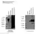 Fig. 19 - ME-5, ME-2, and EPP2: human protein antigens reactive with autoantibodies present in the serum of women suffering from endometriosis