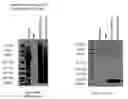 Fig. 20 - ME-5, ME-2, and EPP2: human protein antigens reactive with autoantibodies present in the serum of women suffering from endometriosis