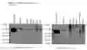 Fig. 25 - ME-5, ME-2, and EPP2: human protein antigens reactive with autoantibodies present in the serum of women suffering from endometriosis