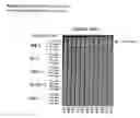 Fig. 28 - ME-5, ME-2, and EPP2: human protein antigens reactive with autoantibodies present in the serum of women suffering from endometriosis