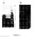 Fig. 02 - Method for assessing risk of and predisposition to development of a pathology related to the presence of anti-epcr autoantibodies