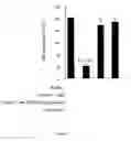 Fig. 04 - Method for assessing risk of and predisposition to development of a pathology related to the presence of anti-epcr autoantibodies