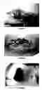 Fig. 04 - Immunoassay for venom detection including noninvasive sample collection