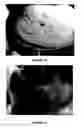 Fig. 13 - Immunoassay for venom detection including noninvasive sample collection