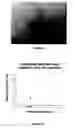 Fig. 15 - Immunoassay for venom detection including noninvasive sample collection