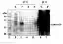 Fig. 01 - Microbial protein expression system utilizing plant viral coat protein