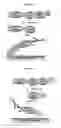 Fig. 06 - HEPATITIS C VIRUS NS2/3 ASSAY