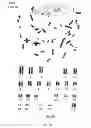 Fig. 12 - Oxygen tension for the parthenogenic activation of human oocytes for the production of human embryonic stem cells