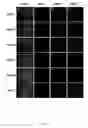 Fig. 16 - Oxygen tension for the parthenogenic activation of human oocytes for the production of human embryonic stem cells