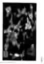 Fig. 25 - Sponge toxins