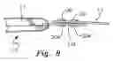 Fig. 06 - Baseball pitching training device