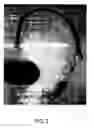 Fig. 03 - Coil ball