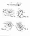 Fig. 06 - TRAINING ARTICLE FOR THROWING AND CATCHING
