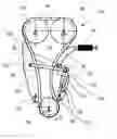 Fig. 01 - Belt assembly with a tensioning device