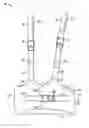 Fig. 01 - Walking training apparatus