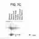 Fig. 12 - Identification and cloning of a novel human gene, RET16, involved in the intracellular signaling cascade