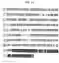 Fig. 24 - Identification and cloning of a novel human gene, RET16, involved in the intracellular signaling cascade