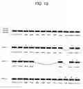 Fig. 27 - Identification and cloning of a novel human gene, RET16, involved in the intracellular signaling cascade