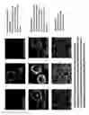 Fig. 10 - Antigen delivery system