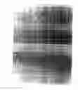 Fig. 04 - Decoy-containing pharmaceutical compositions and method of using the same