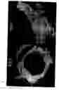Fig. 10 - Decoy-containing pharmaceutical compositions and method of using the same