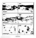 Fig. 04 - Treatment of inflammation and organ dysfunction