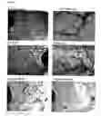 Fig. 06 - Method for inhibiting cancer development by fatty acid synthase inhibitors