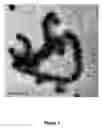Fig. 02 - Nanoparticles with controlled architecture and method thereof