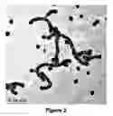 Fig. 03 - Nanoparticles with controlled architecture and method thereof