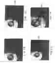 Fig. 03 - Brachytherapy apparatus