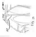 Fig. 11 - Brachytherapy apparatus
