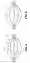 Fig. 04 - Expandable brachytherapy device