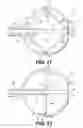 Fig. 09 - Expandable brachytherapy device