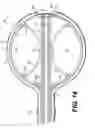 Fig. 11 - Expandable brachytherapy device
