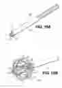 Fig. 12 - Expandable brachytherapy device