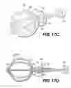 Fig. 14 - Expandable brachytherapy device