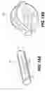 Fig. 15 - Expandable brachytherapy device