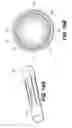 Fig. 16 - Expandable brachytherapy device